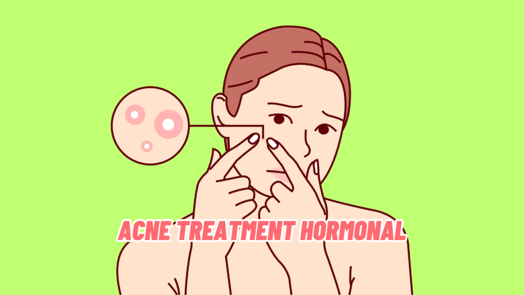 Hormonal imbalances can wreak havoc on your skin, leading to acne breakouts. Discover the best acne treatment options that target hormonal factors and get the clear skin you deserve.