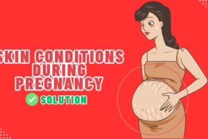 Skin Conditions During Pregnancy: Understanding and Managing Changes